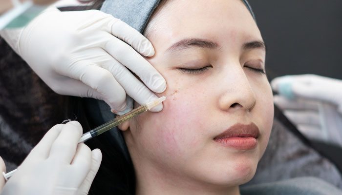 botox