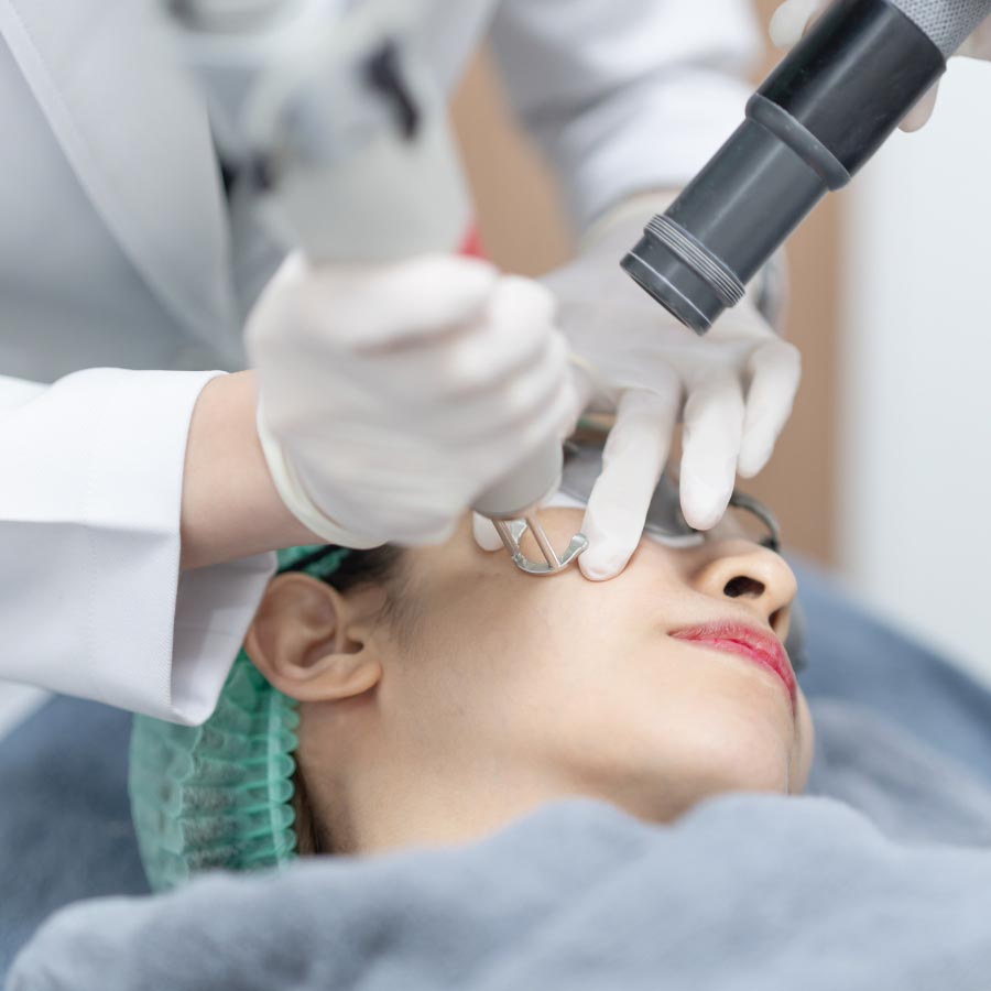 Laser flek di Bandung bersama Holistik Estetika